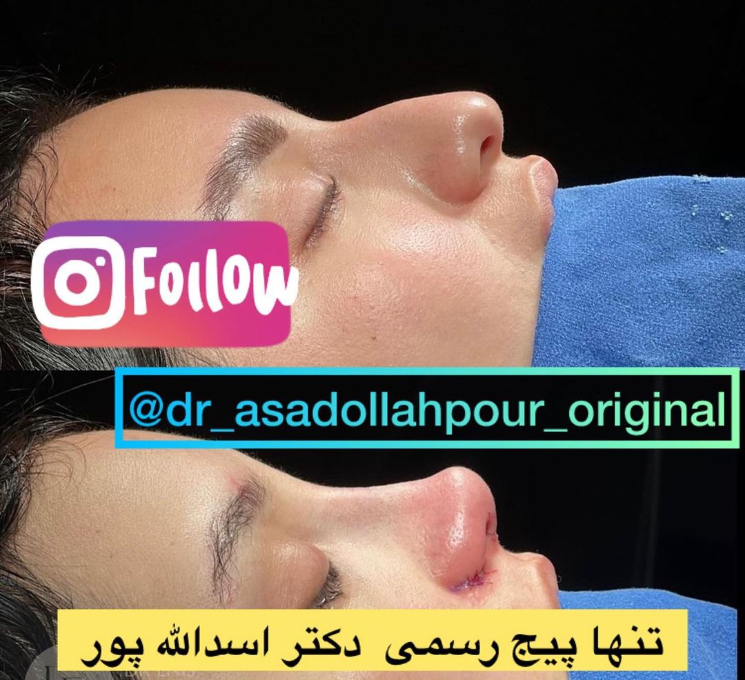 مراقبت‌های پس از عمل