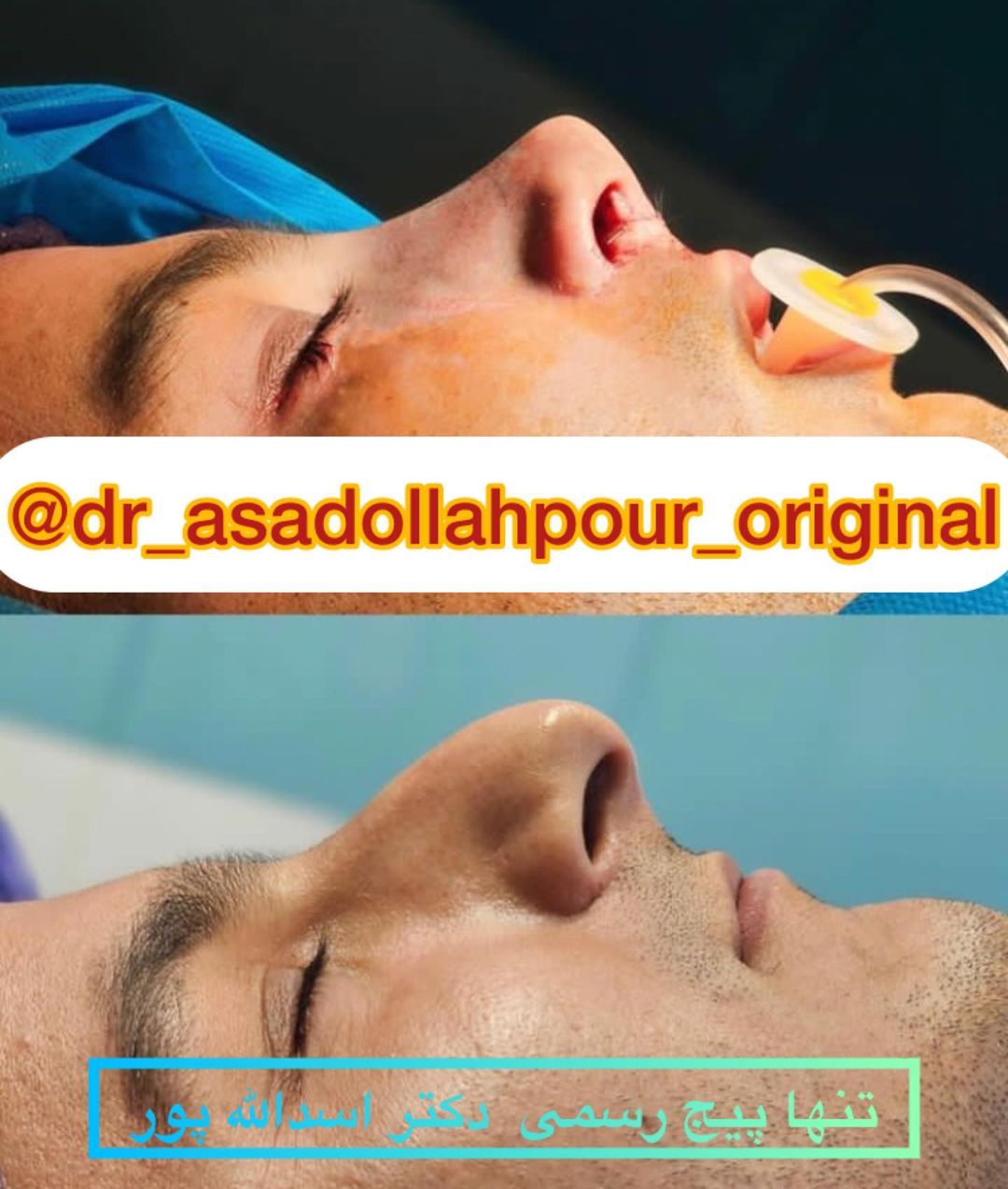 بیهوشی ایمن