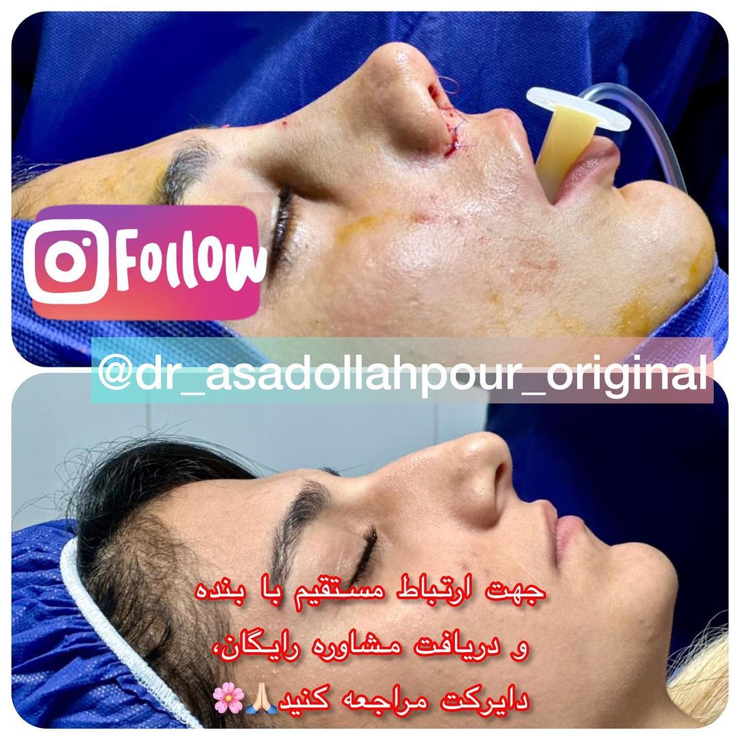 زیبایی و سلامتی در یک جراحی